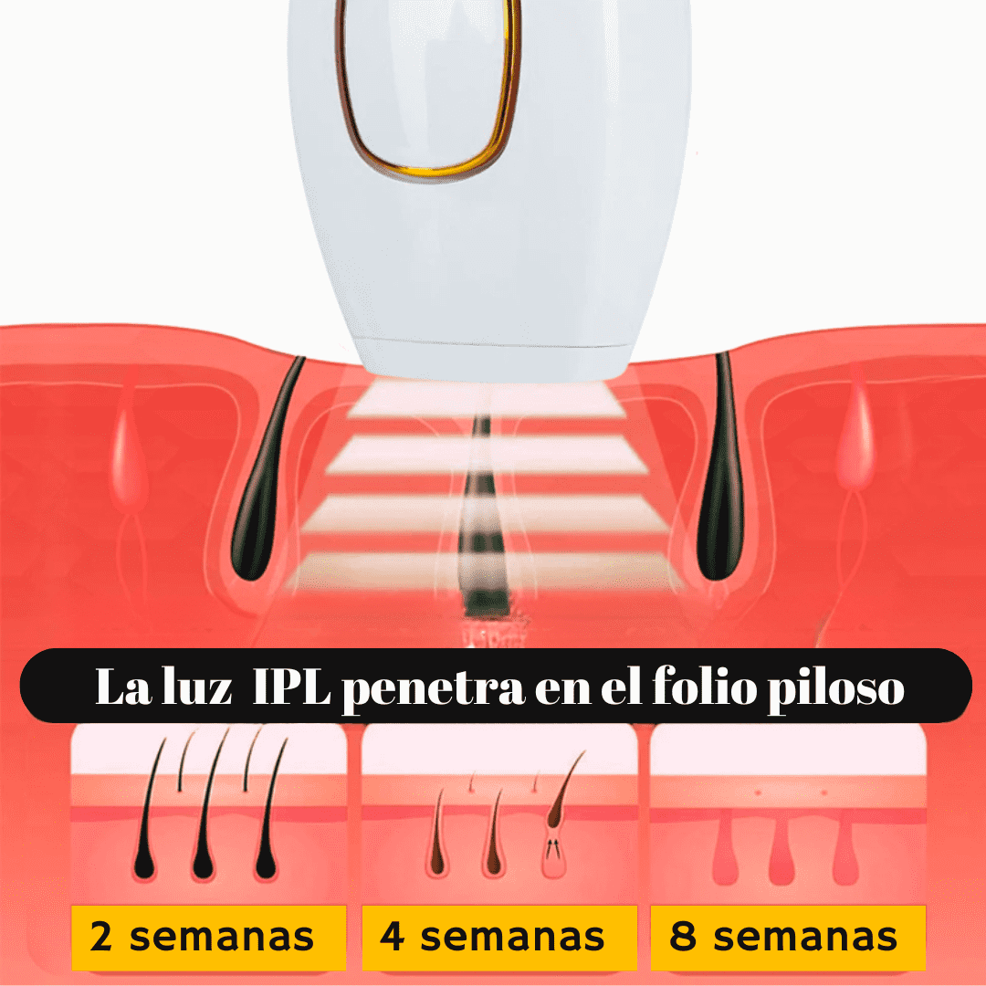 DEPILADOR LÁSER (IPL) PARA DAMAS Y CABALLEROS